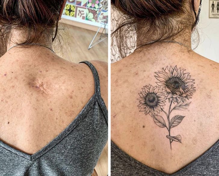 Tattoos that help turn your scars into something beautiful