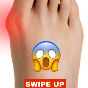 “Gout in the Big Toe: Navigating the Severity of This Painful and Serious Disease”