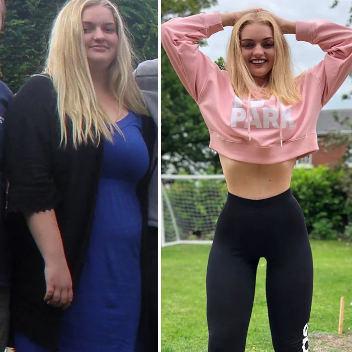 Bullied Teen Loses 132 lbs Before School Dance, Stuns Everyone With Her Transformation