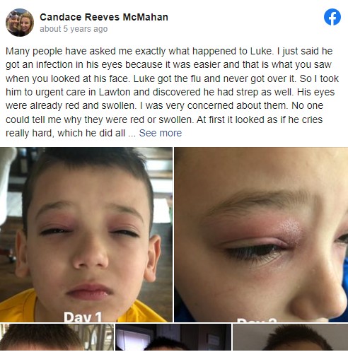 Her son came home with a red mark on his face, so she rushed him to the Emergency Room. This is scary stuff for parents everywhere.