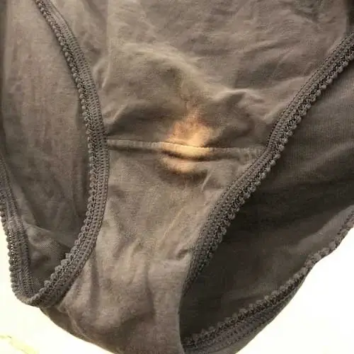 This is what it means if you find a “bleach” spot on your underwear